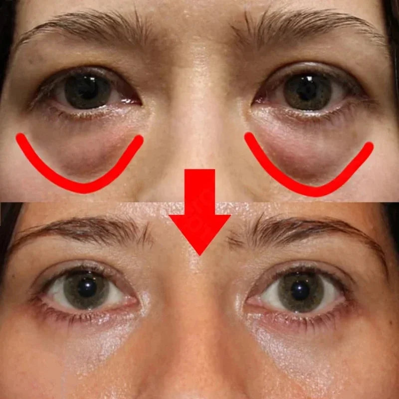 Eyes Bag Remove Collagen Eye Patch Instant Fade Fine Line Dark Circles Fat Particles Moisturizing Anti-Puffiness Korea Eye Care