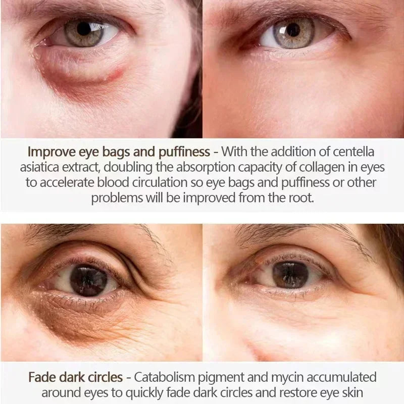 Eyes Bag Remove Collagen Eye Patch Instant Fade Fine Line Dark Circles Fat Particles Moisturizing Anti-Puffiness Korea Eye Care